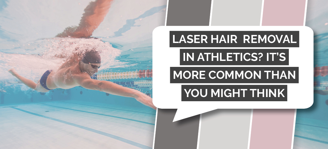 Laser hair removal in athletics is becoming more common