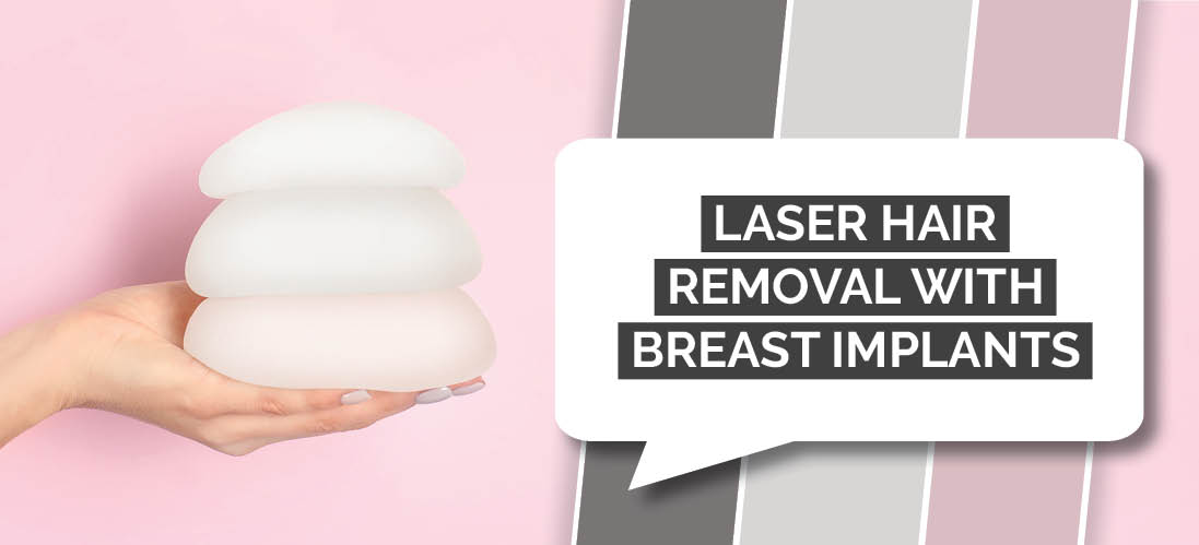 Laser Hair Removal With Breast Implants - Laser Hair Removal Near Me: The  Largest Directory of Laser Hair Removal Companies