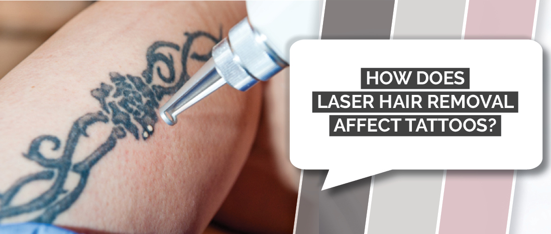 Laser hair removal vs tattoo pain  Skin Perfection
