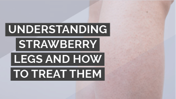 Understanding strawberry legs and how to treat them