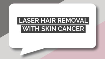 Laser Hair Removal with Skin Cancer