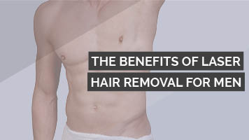 The Benefits Of Laser Hair Removal For Men