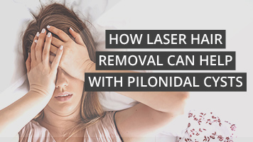 How laser hair removal can help with pilonidal cysts
